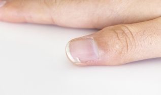 How To Stop Premature Nail Splitting